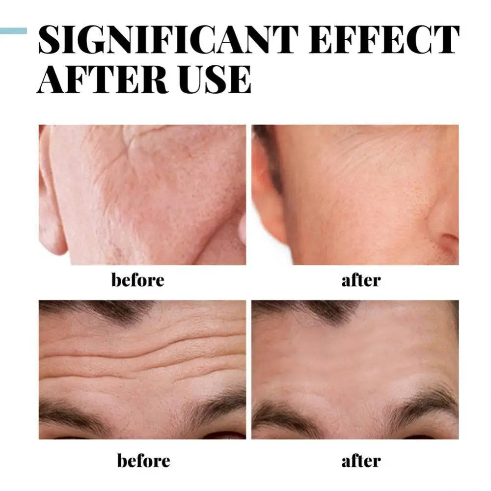 Face skin before-and-after results with cream application shown
